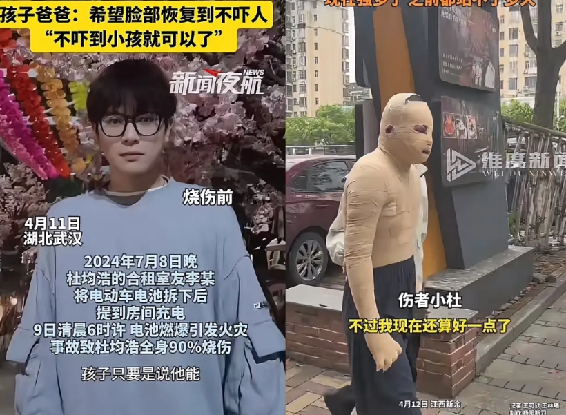 小杜烧伤前长得又高又帅，在看烧伤之后的模样连我一个陌生人都接受不了，他父母又怎么