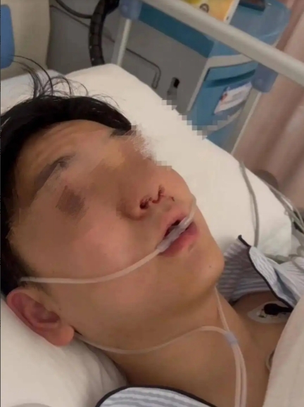 “严查到底！”重庆，一男子出小区遛狗时，突然被女邻居家2条未栓绳的狗追赶，最终将