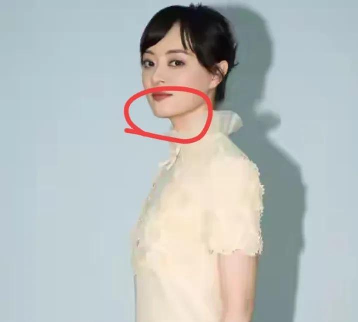 孙俪真的是个谜
让人完全看不懂了
先前网友都呼吁她把那个下巴痣给取了，她无动于衷