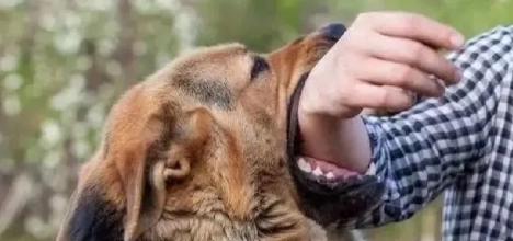 养狗不拴绳，必须立法严惩！

看了贵州毕节小男孩被恶犬撕咬之悲惨消息，联想到小男