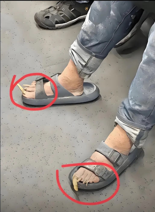 哪天一脚踢到台阶上就老实了...