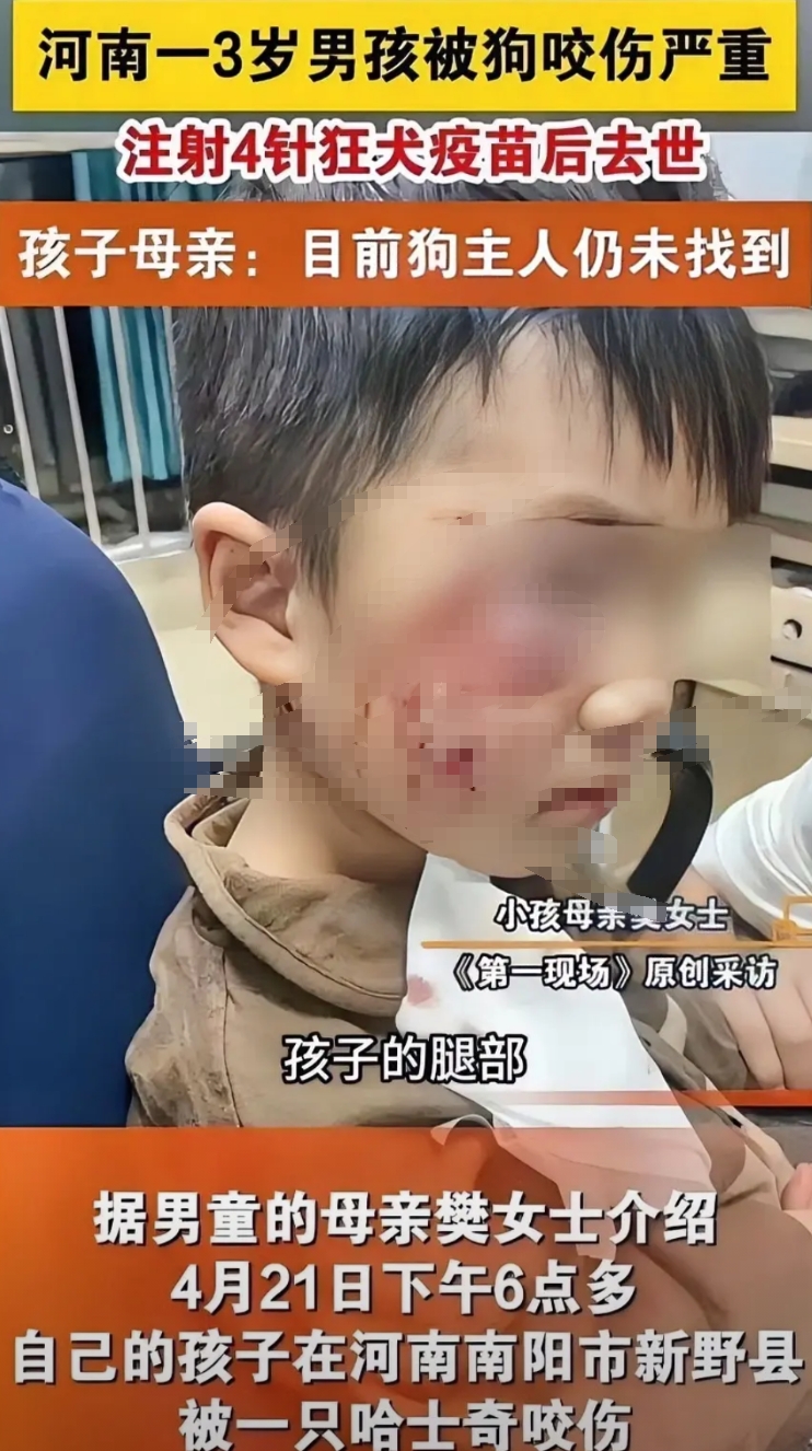 4月21日，河南南阳市新野县一三岁幼童被狗咬伤，打4针狂犬疫苗仍然去世，但是至今