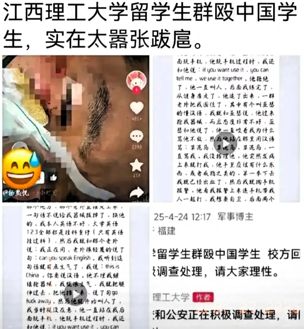 留学生暴力事件背后竟有如此多猫腻，着实令人愤怒。就拿江西理工大学那件事来说，中国