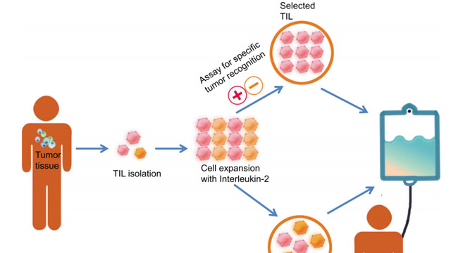 美国疗法370万，中国“平民版”TIL疗法2026年有望上市！肺癌、卵巢癌、肝癌、宫颈癌等患者的希望