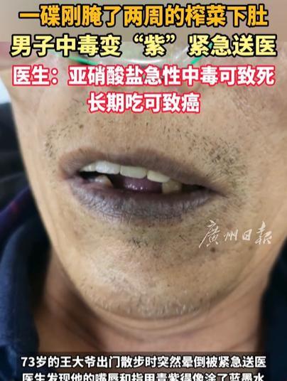 2025年，宁波一大爷散步时突然晕倒，肤色变成“紫精灵”！一问才知，大爷中午吃了