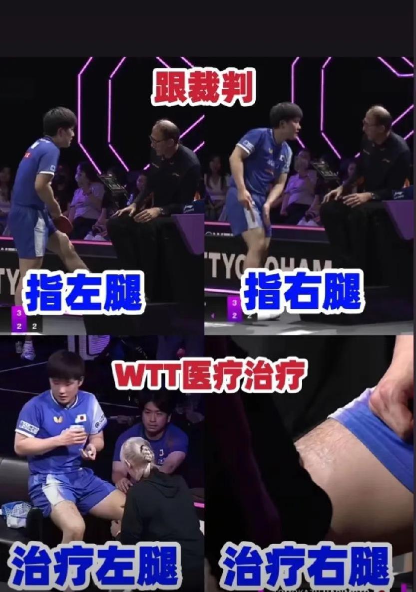 张本智和医疗暂停没有问题哈
张本美和和早田的那场是打到决胜局，美和领先的情况下，