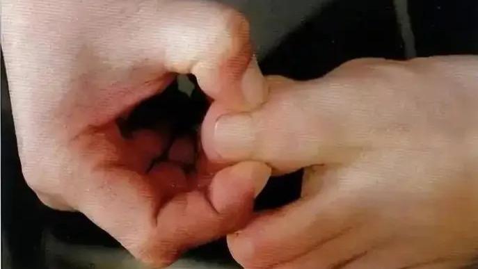 五指经络小窗口，健康状况早知晓