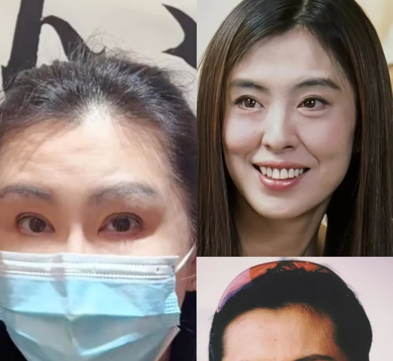 只是好奇王祖贤的眼睛是不是医美失败了 ，很多网友留言说她眼睛的形状和以前不一样了