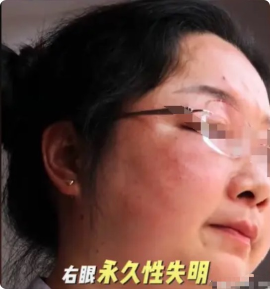 河南信阳，女子没钱买菜了，她伸手向丈夫要生活费，不料丈夫不但不给钱，还和她吵了起