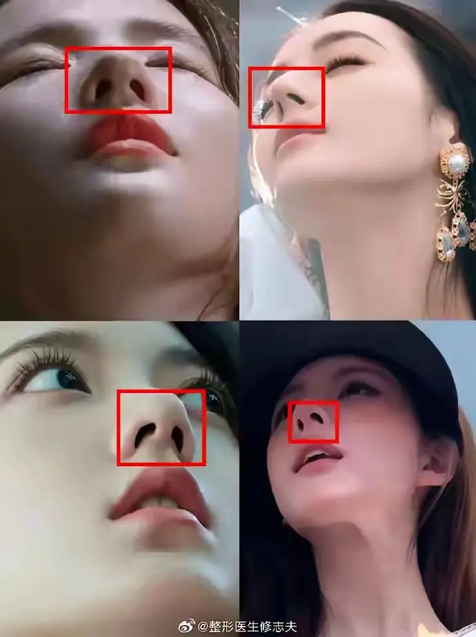 女星们的鼻孔也无死角，都是瘦瘦高高站着的，你们的鼻孔呢？