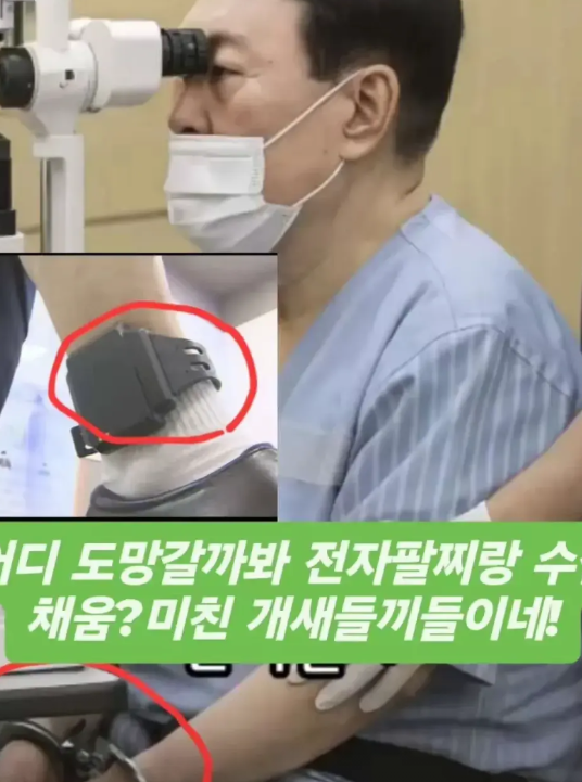 对尹锡悦的关押，整个看守所还是实行人性化的。由于尹锡悦的眼部存在疾病必须得检查，