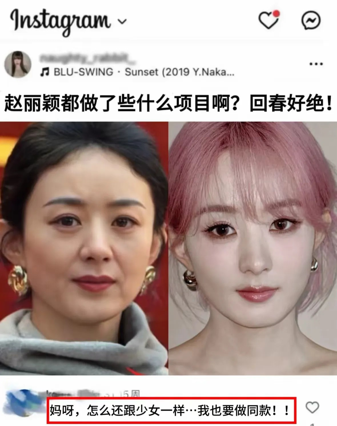 赵丽颖也老了，毕竟快40岁了，有点阿姨那味了。