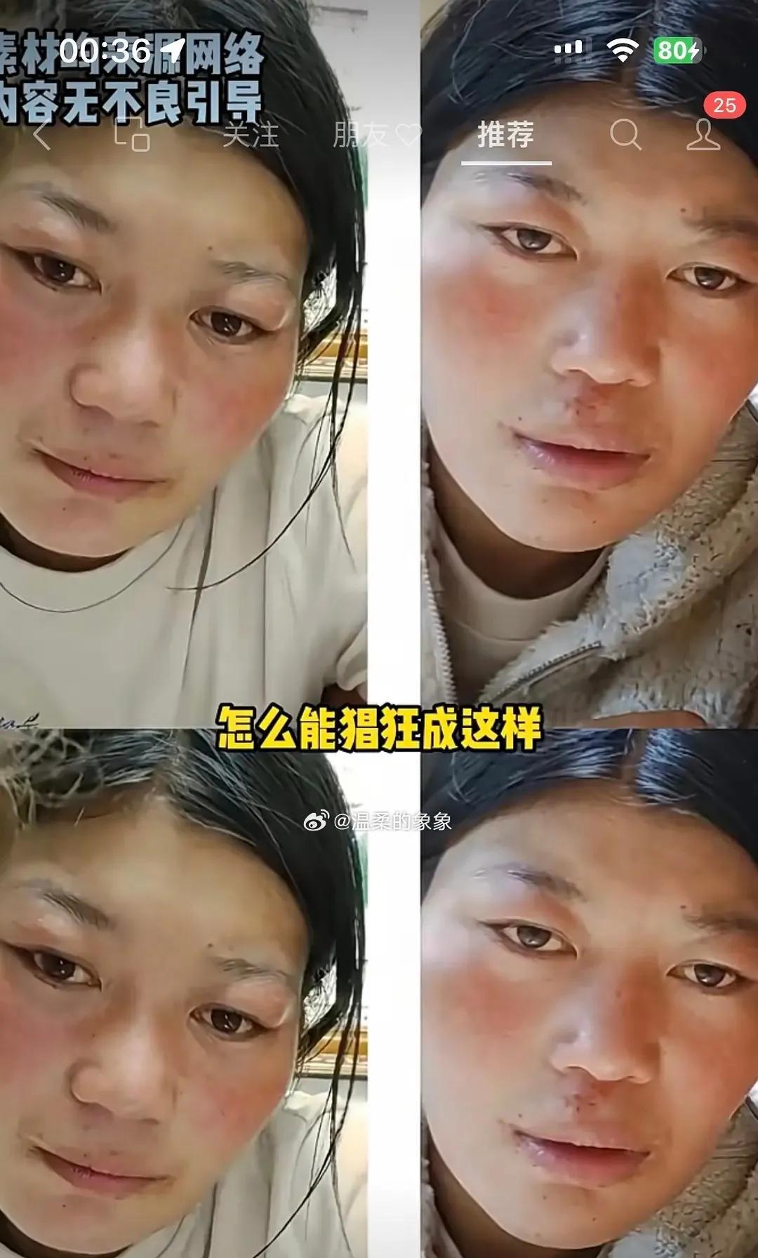 甘肃男网红直播家暴残障妻子：“打不走骂不跑”的畸形炫耀背后，是法律与人性的双重拷