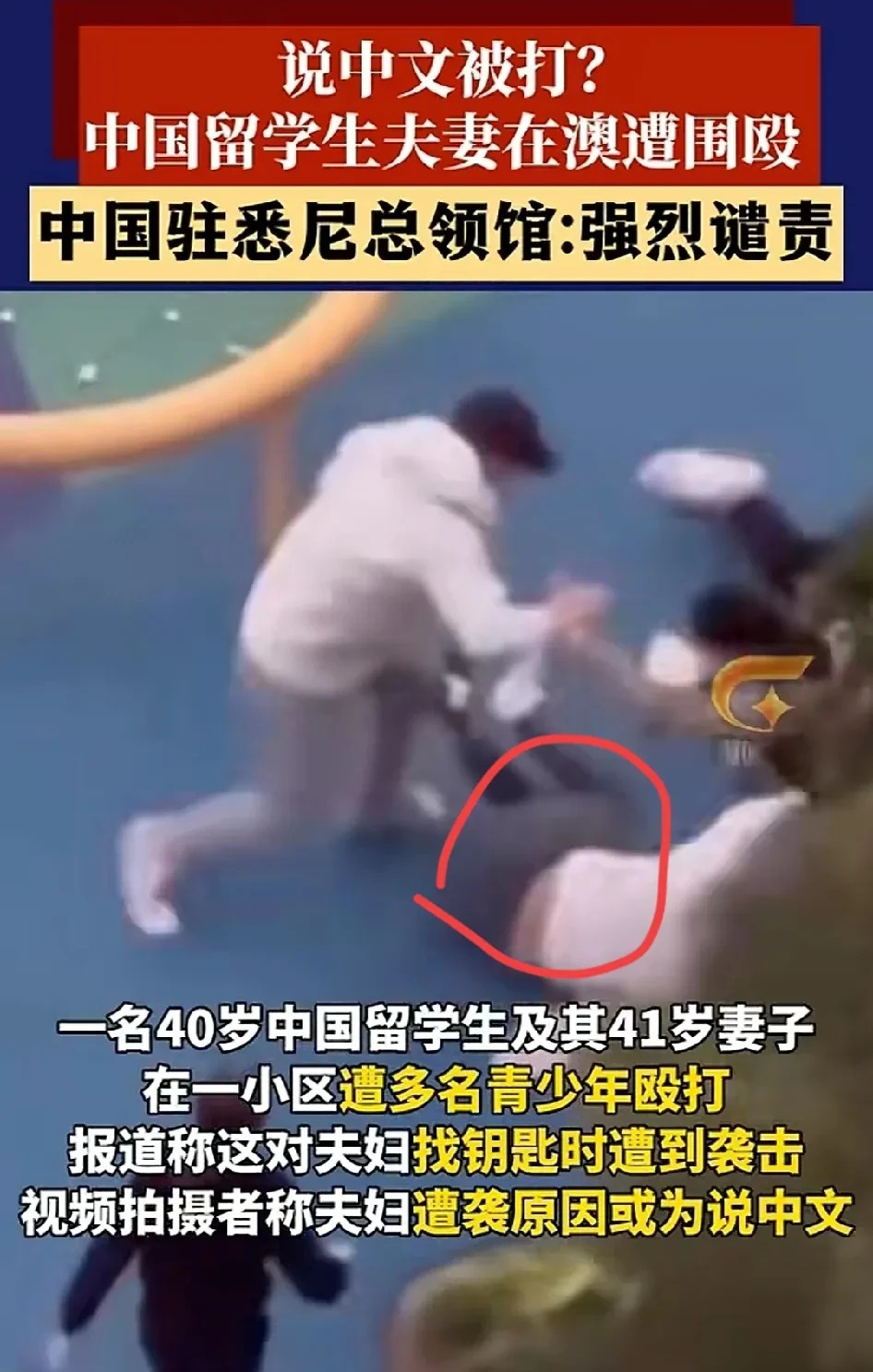 海外遇袭：老公咋没出手





---





这事儿真是让人气炸了！一对小