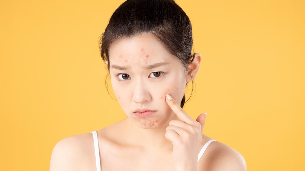 闭口怎么去掉？