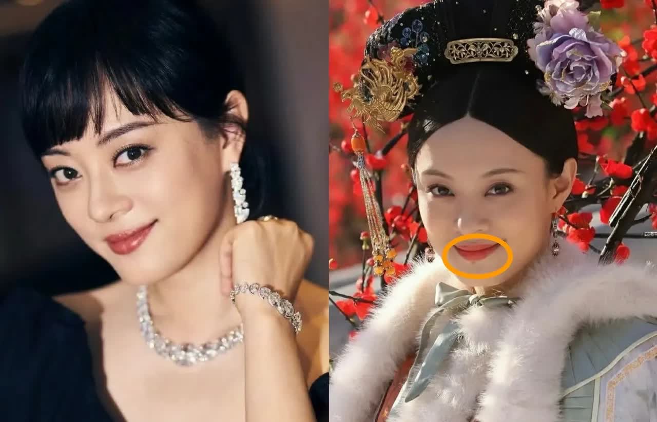 大家发现了吗？孙俪嘴唇下面的那颗痣没有了。

原来这颗痣是车祸留下的，是玻璃