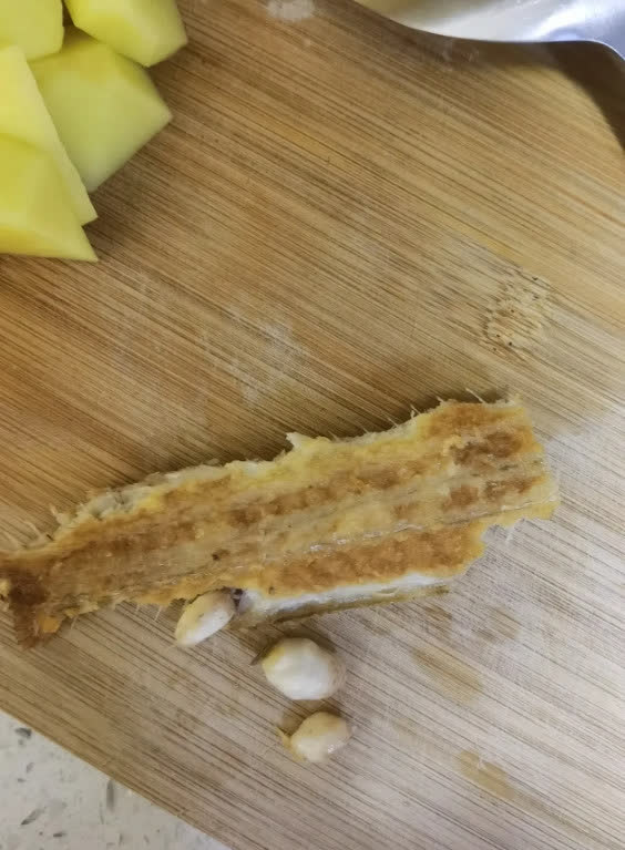贵州女子吃鱼惊现三颗硬颗粒，这是啥东西？