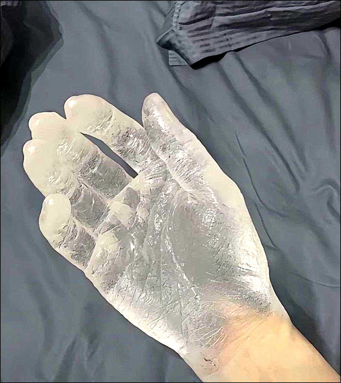 帮忙看一下这是得了什么病呀