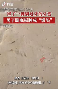 太危险了！近日报道，广东深圳，一男子饭后用牙签剔牙，之后顺手把牙签一扔，一个没注