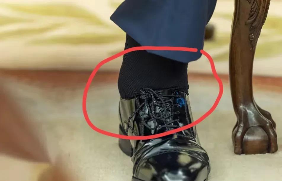 这是特朗普的脚
仔细看肿的把皮鞋都撑的没有缝隙，原因白宫称他患有慢性静脉功能不全