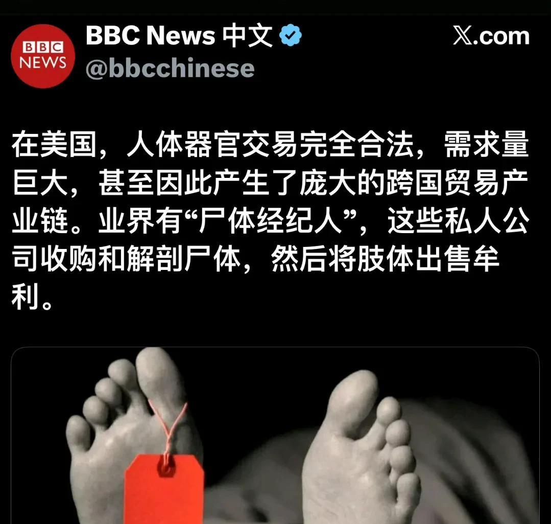 BBC 报道美国人体器官交易，称美国成为全球“尸体出口国”。
美国总人口占全世界