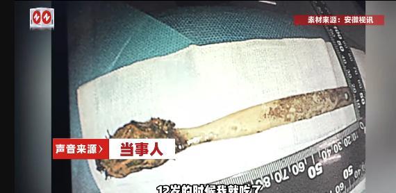 “真是命大！”安徽滁州，64岁老人时常感觉胸口不舒服，有时发闷喘不上来气，有时疼