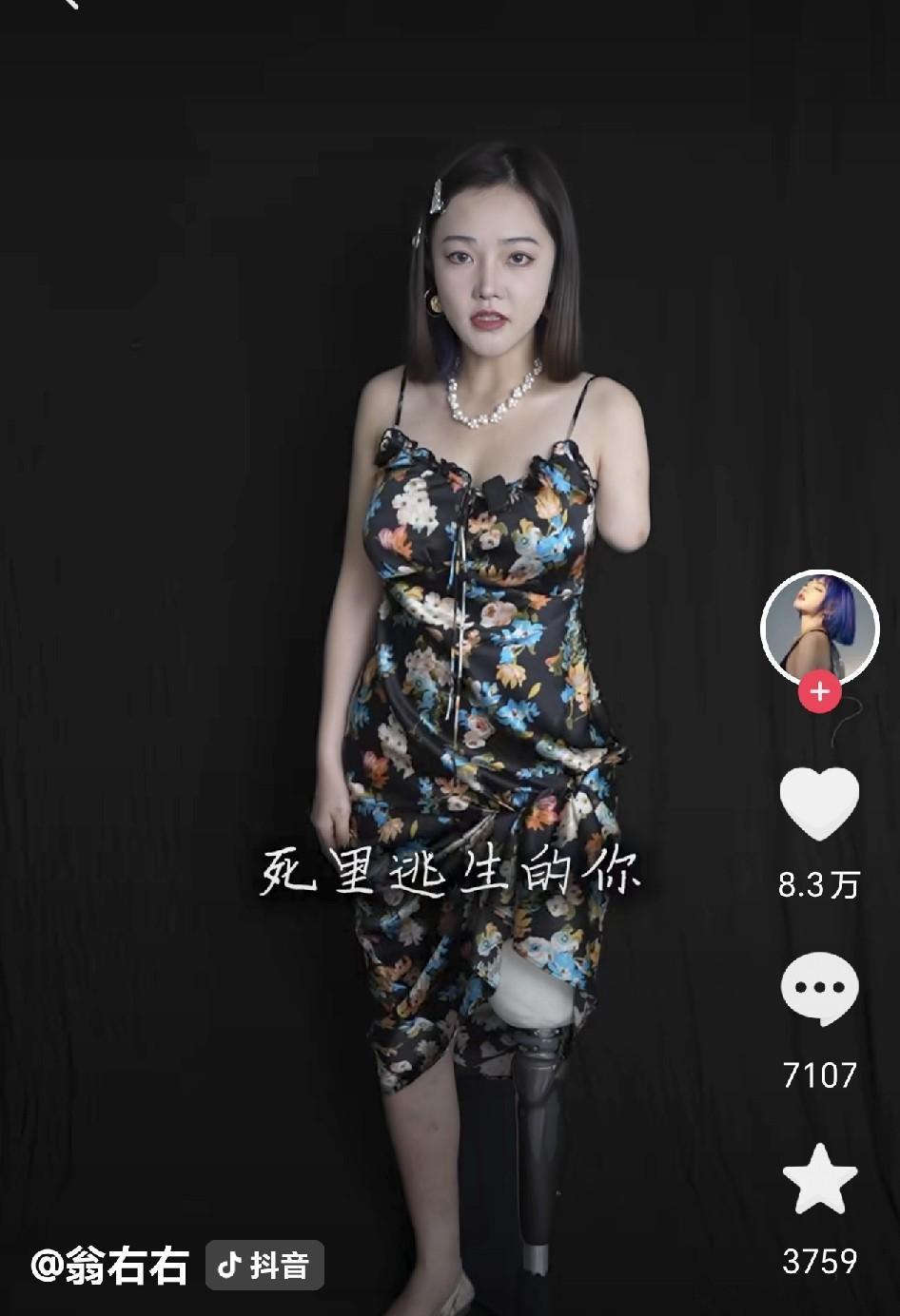 比王暖暖还励志，只不过小翁右右是车祸，不是人害。翁忻怡，1995年广西南宁人，2