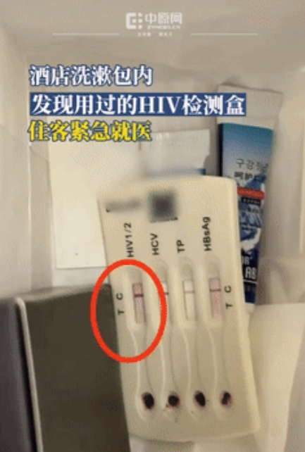 太吓人了！一对情侣住酒店，晚上洗漱完毕后，才发现洗漱包里有用过的HIV检测盒，看