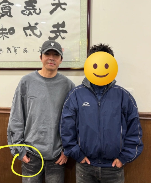3月7日网友在餐馆偶遇素颜现身的他，面部烧伤疤痕清晰可见却坦然合影。左手中指银色