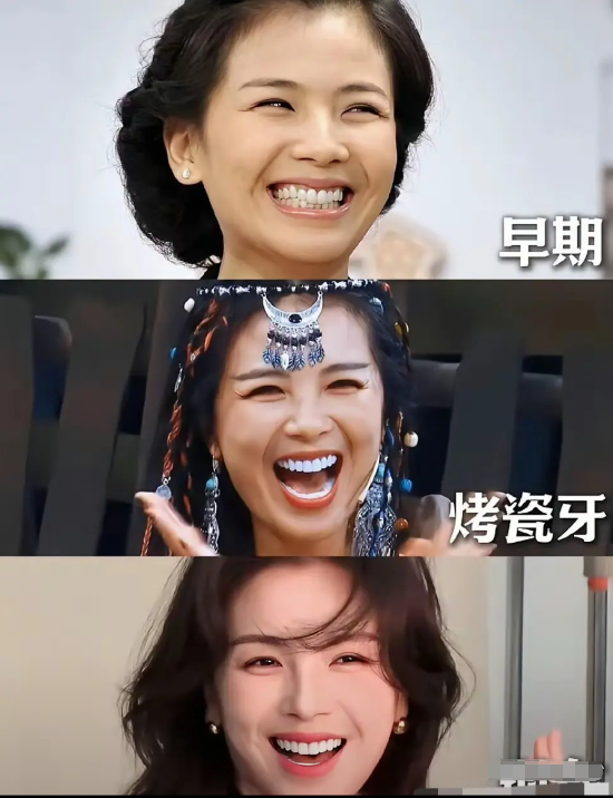 不得不说，牙齿矫正确实很重要啊……