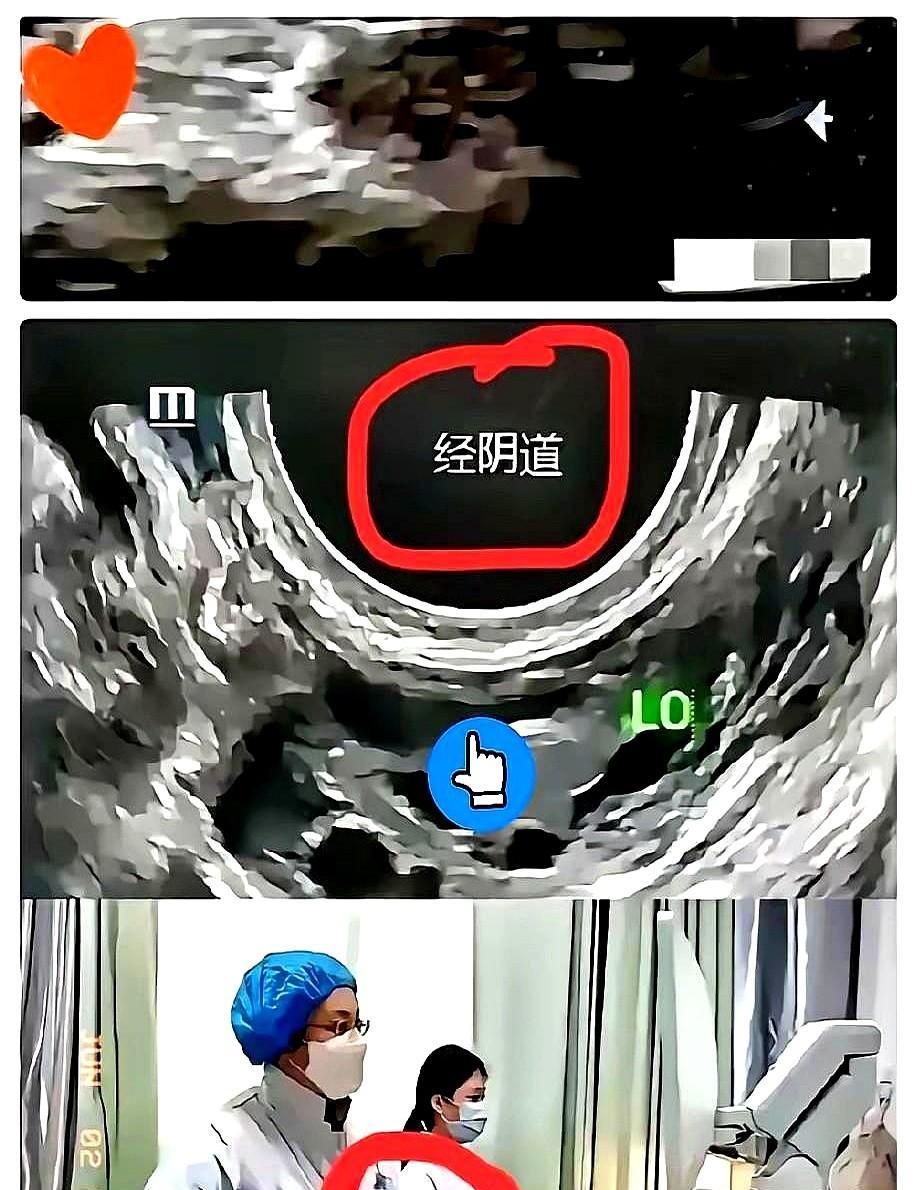 苏州医院"阴超"事件，震碎三观！
现在签字单这玩意儿真是越来越玄乎了！上礼拜朋友