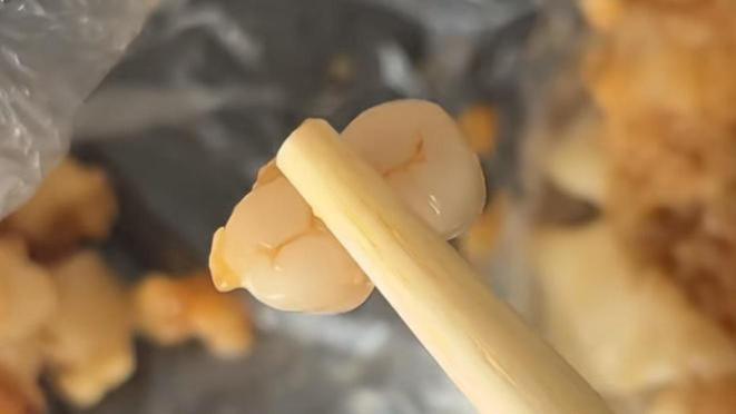 烧卖里吃出“两颗相连牙齿”？你的假牙也该年检啦