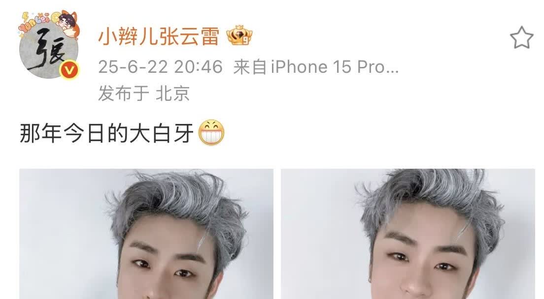 @张云雷 回来后的第一个微博，深深的锁骨，雪白的牙齿，灰白的头发。在微博里与檬檬