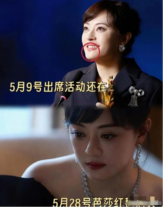 孙俪把唇下痣切了
不是因为怕影响颜值，也不是粉丝跪求她点痣，而是她突然发现，自己