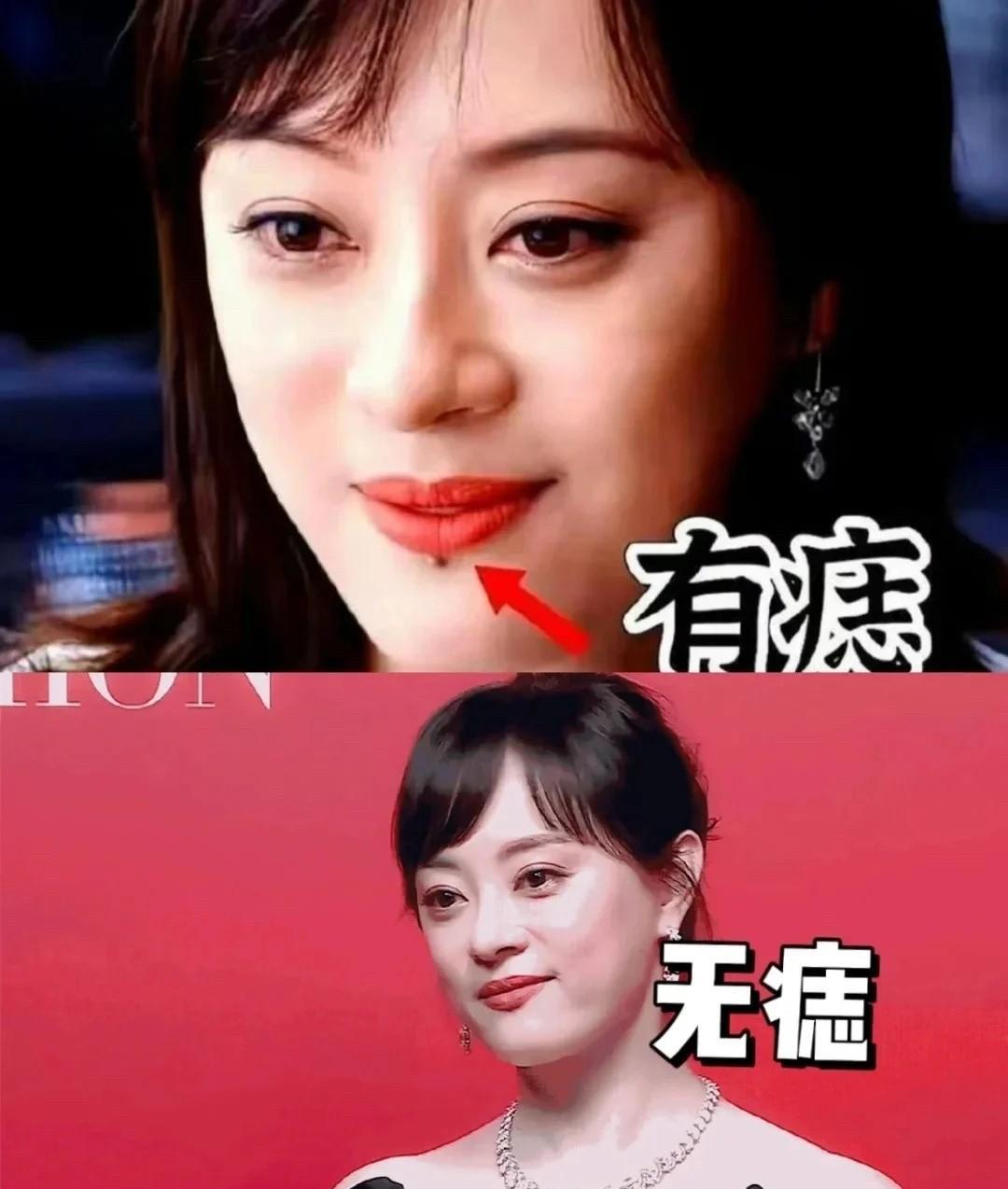 孙俪可能没有意识到，
她把唇下痣切了之后，
将会面临什么，毕竟
——中年得“痣”