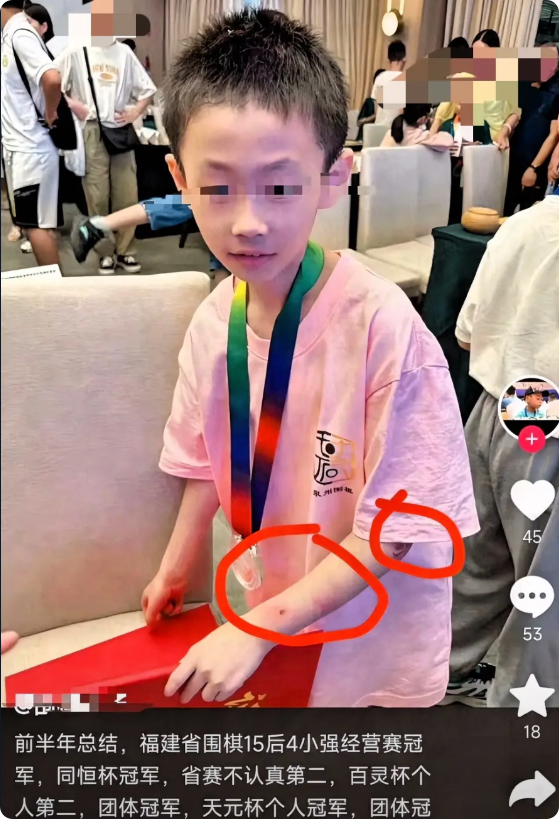 痛心，天才少年一跃而下！

围棋天才朱宏鑫，

19号晚上从楼上跳下，为什么这么