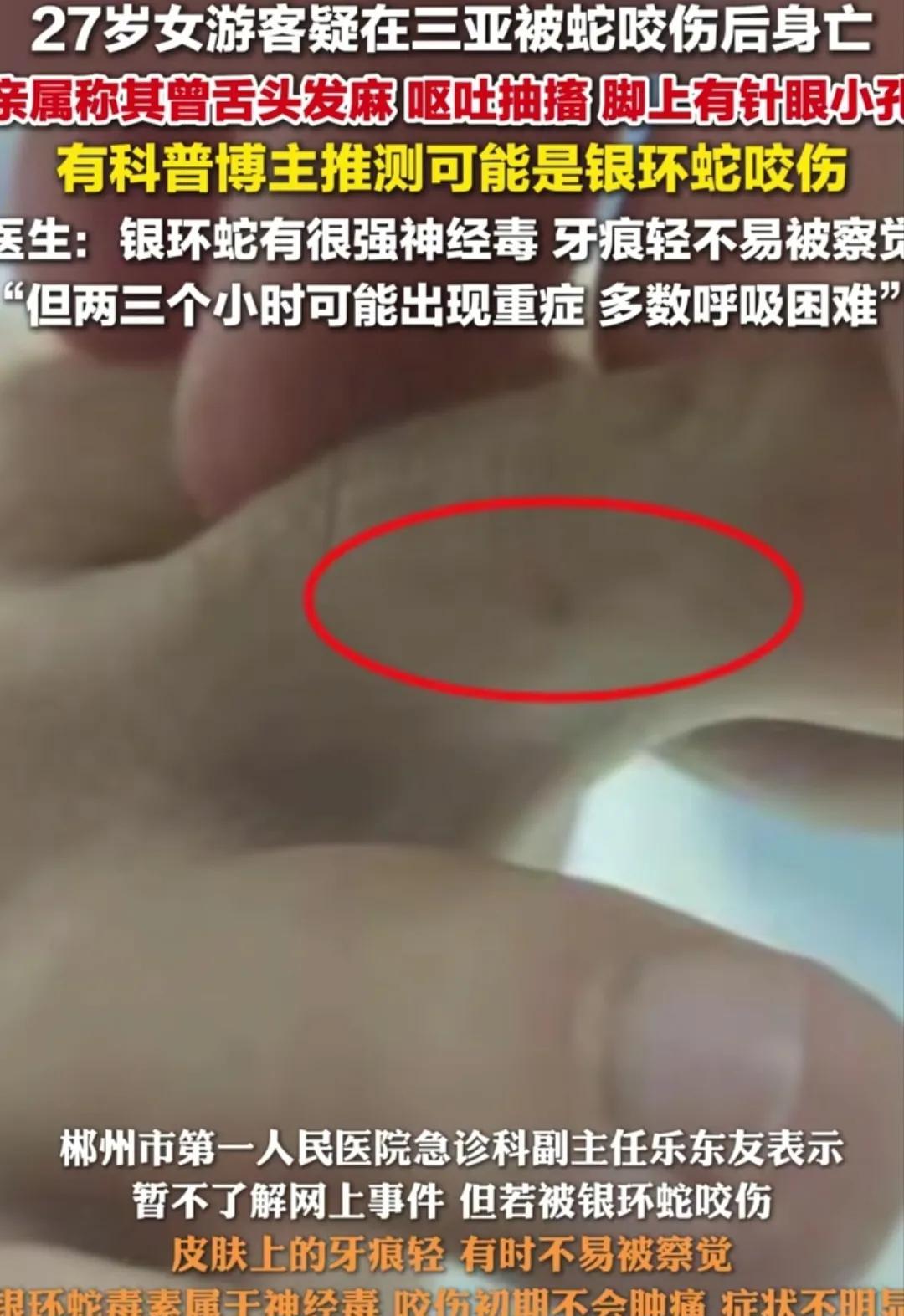 27岁女孩在三亚被蛇咬伤身亡这事，
我特意查了下，不查不知道，一查才发现这个忽视