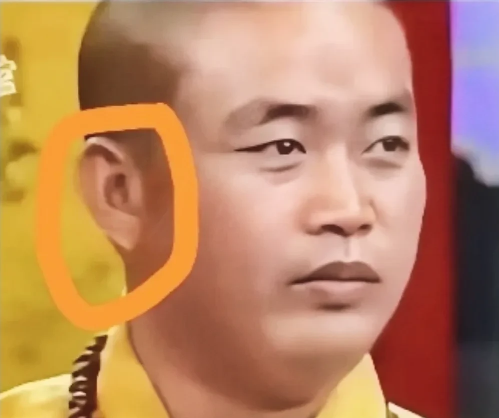 释永信被扒耳垂秘密！[擦汗]

玻尿酸打造