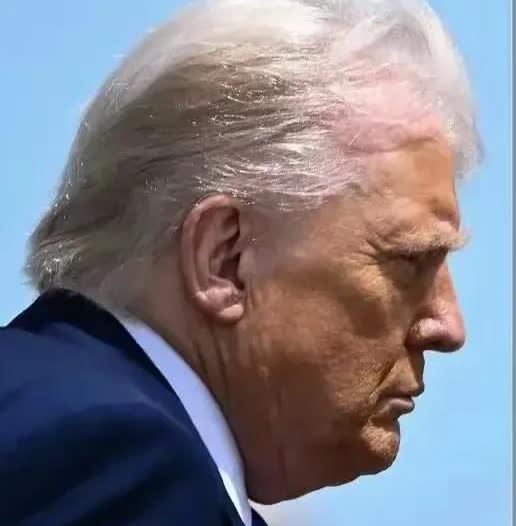 特朗普拼命给美国续血。
其实也并不高明，但是他确实再做！
如果美国没有做那么