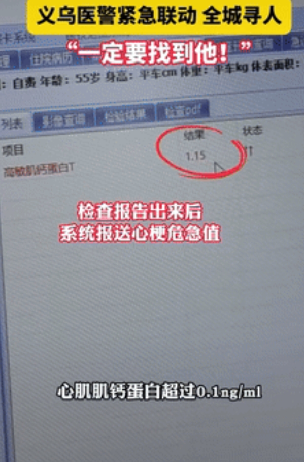 “福大命大！”浙江义乌，57岁大叔胸闷去医院检查，等不及结果就走了，不料医生一看