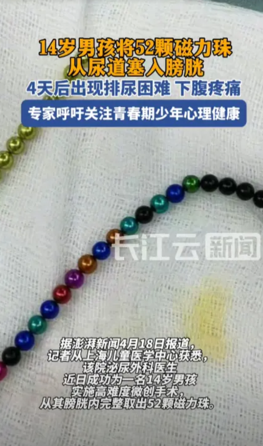 “活久见！”2025年4月，上海，一名14岁的小男孩因为青春期和好奇心驱使，竟把