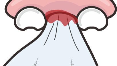 儿童乳牙磕断了怎么办？这有春节应急处理，家长别慌