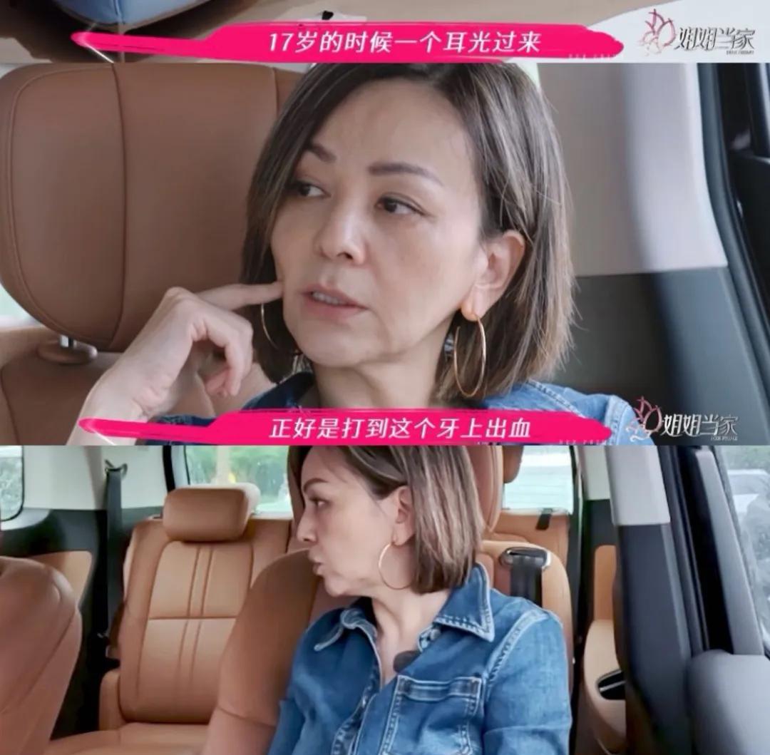 妈呀，王琳竟然也被自己的儿子打过，甚至还被打的牙出血了，只能说：这孩子被惯得没治