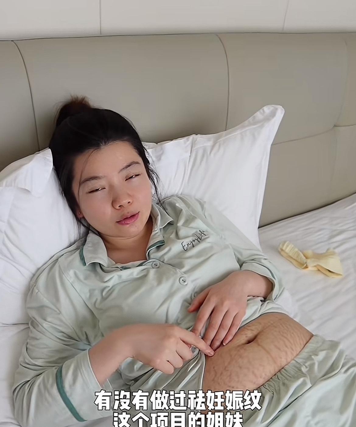 怀孕生孩子对女人身体的影响真的太大了。
黄喂喂之前有马甲线，现在肚子上长满了妊娠