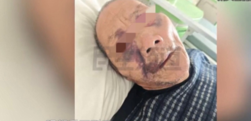 6月16日一河南女子把71岁的父亲送进养老院，结果接到消息，说父亲摔伤了，她去医