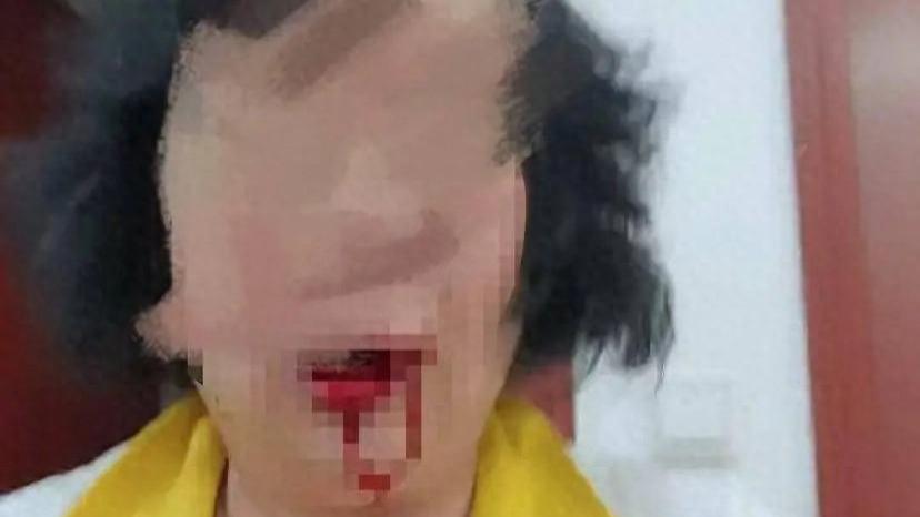 广州六旬老人退管所办事遭工作人员打伤，警方介入调解未果