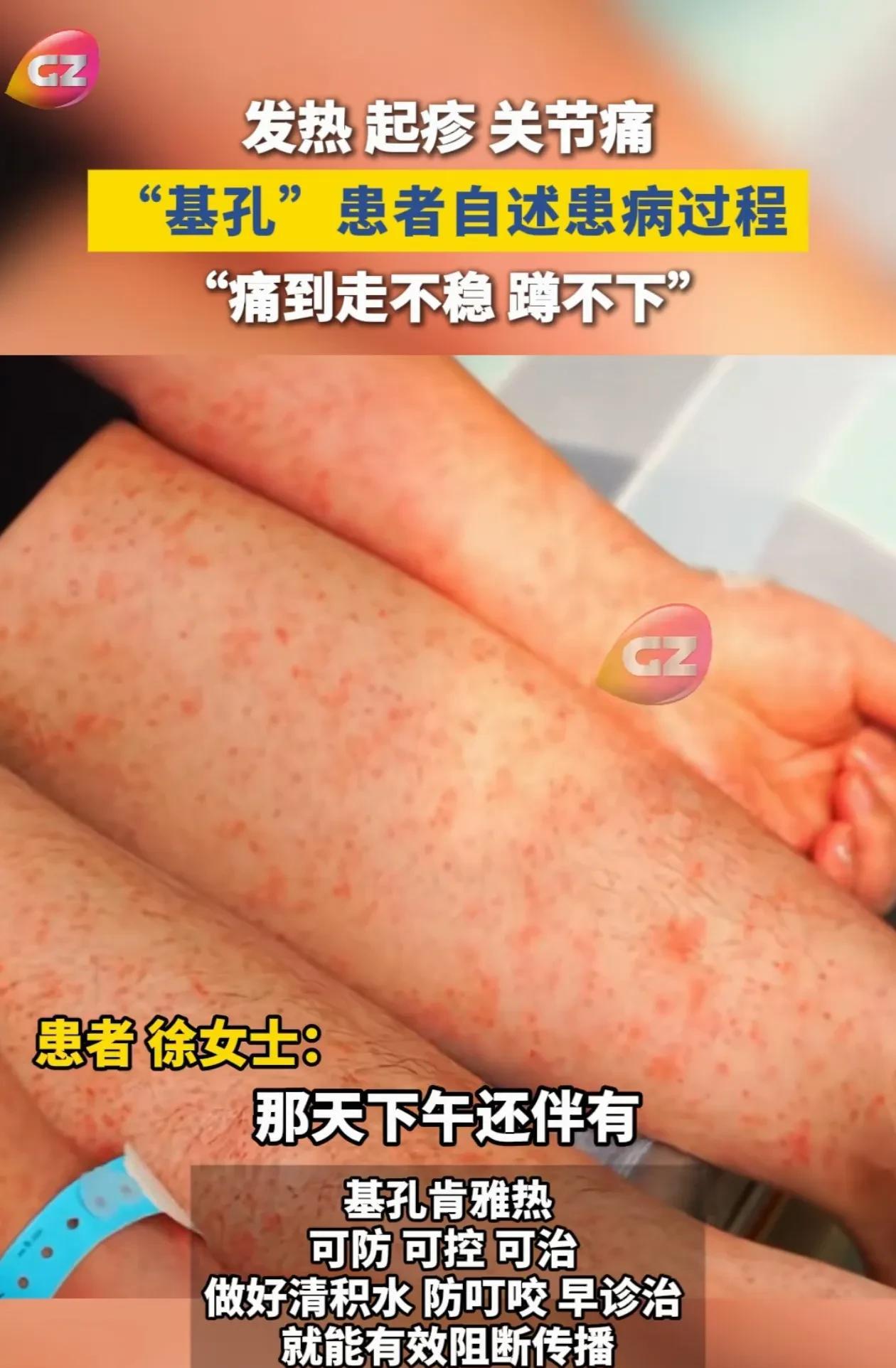 天哪，看着怪吓人，新冠让很多人得了肺结节后遗症，这个病也不知道什么后遗症[捂脸]