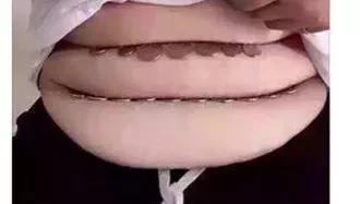 真有这样胖的肚子吗？这照片这个人的肚子一圈一圈分成三层，这样的肚子还是第一次见到