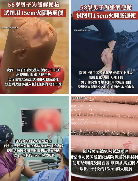 医生：又是这理由，诡计多端的病人！

7月16日，西安市人民医院普外科从58岁男