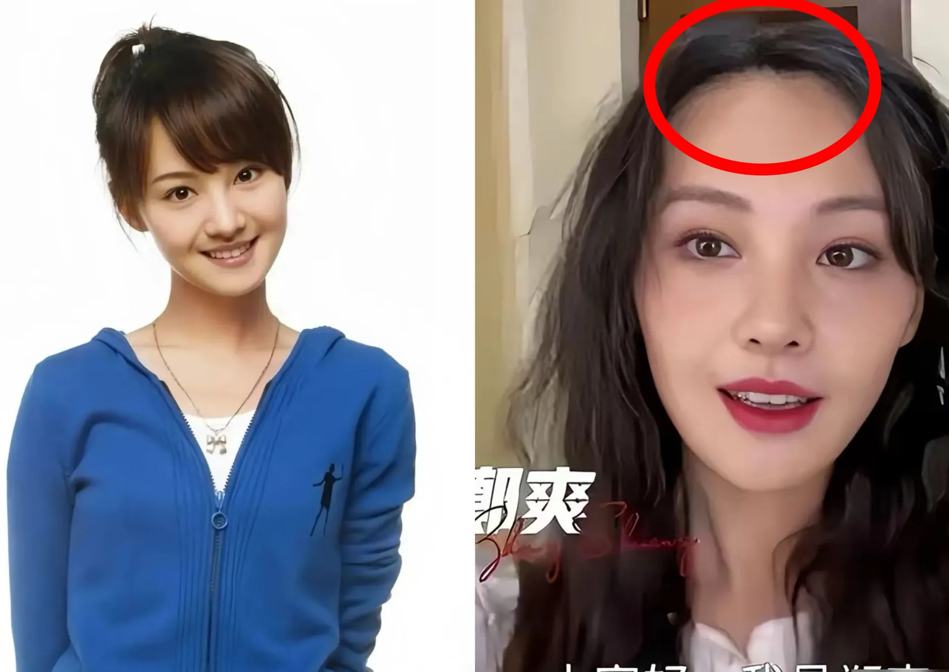 郑爽现状引奶奶担忧











我的天哪！我奶奶居然也懂发际线梗！我给